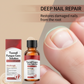 💅 50% RABATT – Negleessens for tørre og sprø negler – fuktighetsgivende – styrkende – pleiende formel – for hender og føtter – enkel daglig rutine