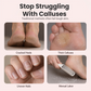 🎉45K+ Sold 🦶 Rechargeable Electric Foot Grinder, Effortlessly Remove Hard Dead Skin & Foot Calluses