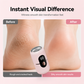 🎉45K+ Sold 🦶 Rechargeable Electric Foot Grinder, Effortlessly Remove Hard Dead Skin & Foot Calluses
