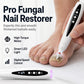 🦶 50% RABATT – Elektrisk neglefornager – høyt dreiemoment – profesjonell kvalitet – ergonomisk – for tykke negler og soppnegler – enkel og effektiv pleie